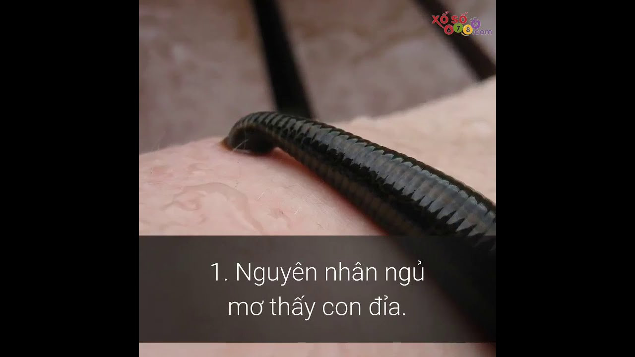 Mơ Thấy Đỉa Cắn Kinh nghiệm của chuyên gia bài viết